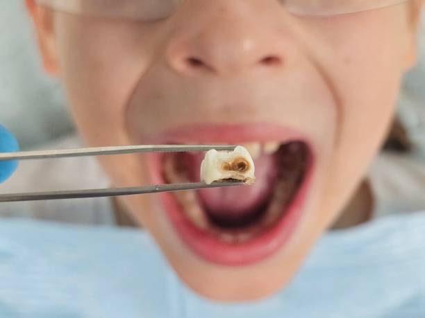 Best Urgent Dental Care  in Connerton, FL